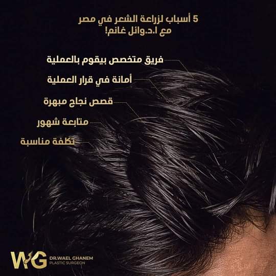 أسباب زراعة الشعر