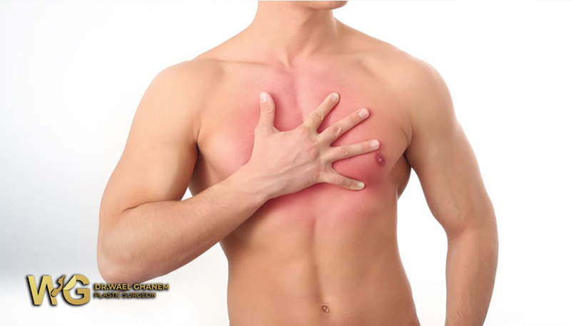 تثدي الرجل الكاذب.. أسبابه وتشخيصه وطرق علاجه