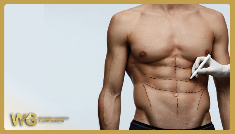 عملية نحت الجسم للرجال