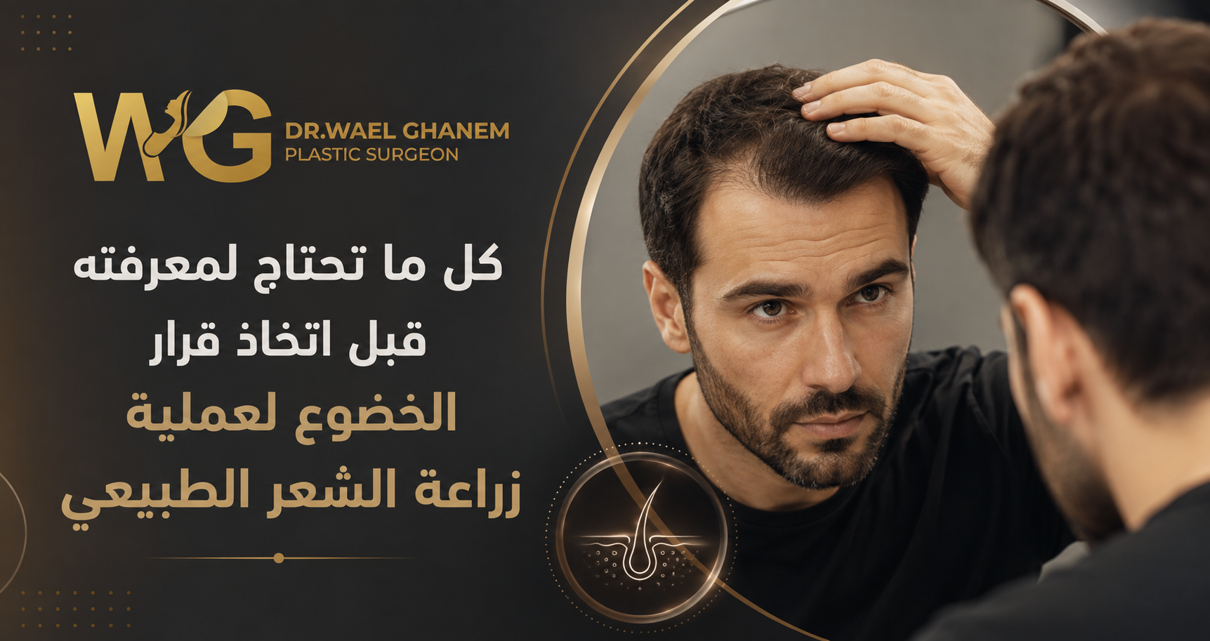 زراعة الشعر الطبيعي 