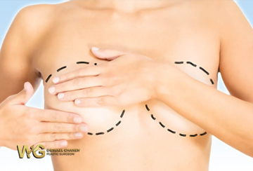 Breast Plastic Surgeries